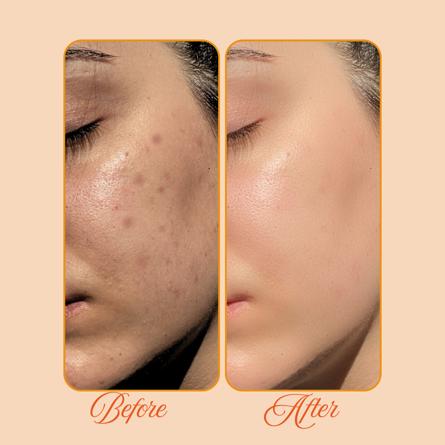 Vitamin C Face Serum — 30ml | Cerasus Nature & Science