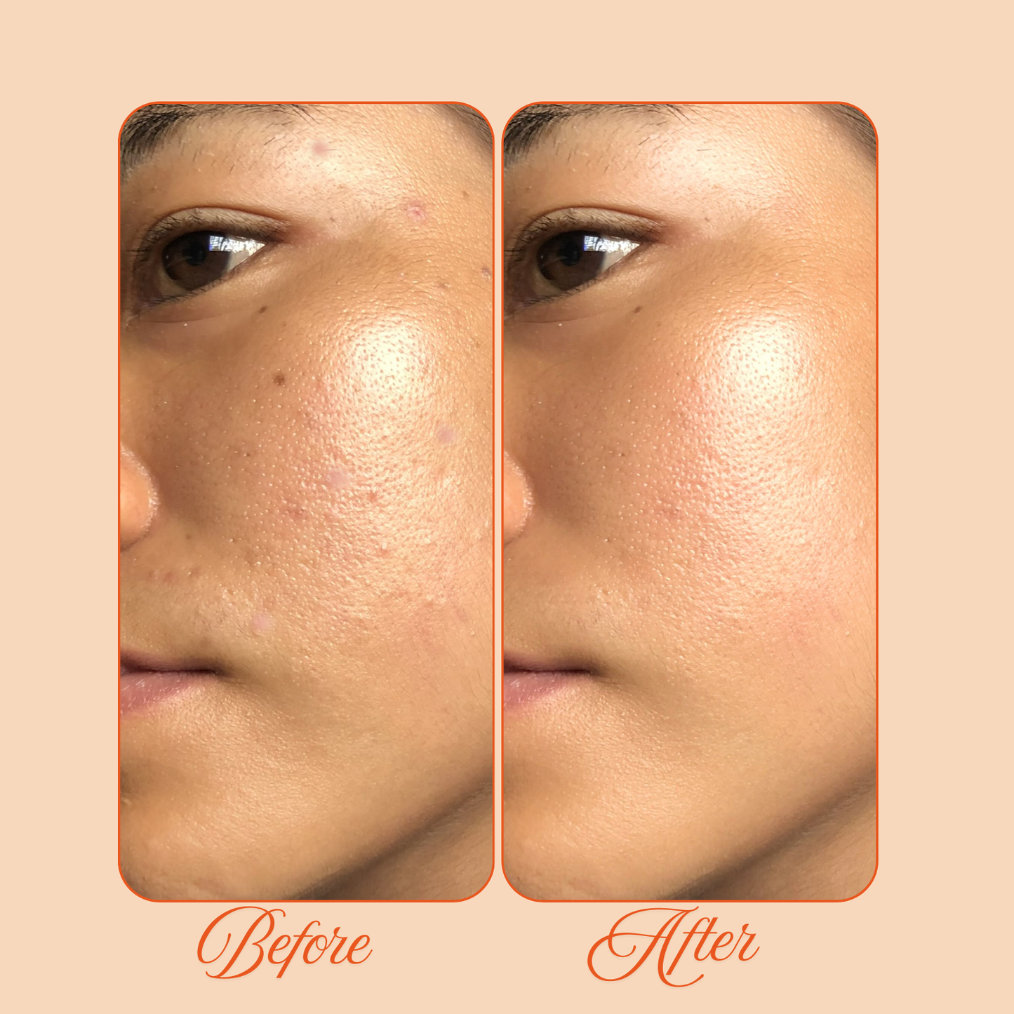 Salicylic Acid Face Wash — 100ml | Cerasus Nature & Science